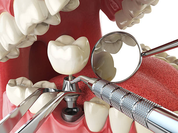 Best 24-Hour Emergency Dentist in Waldorf, MD